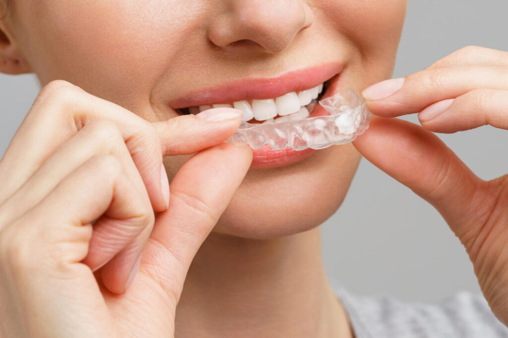Adult placing clear Invisalign aligners on teeth for discreet orthodontic treatment in West Chester, PA.