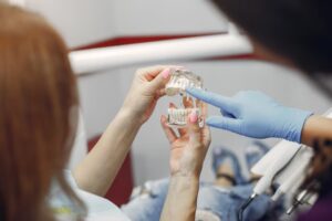 dental bridges