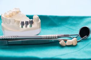 Dental implant model with artificial teeth and dental instruments on a blue surgical cloth.